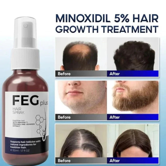 FEG Plus Hair Growth Spray 50ml Cyntinostore