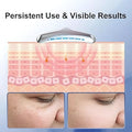 Digital Face and Neck Massager 3 Mode Vibration, LED & Heat Therapy Cyntinostore