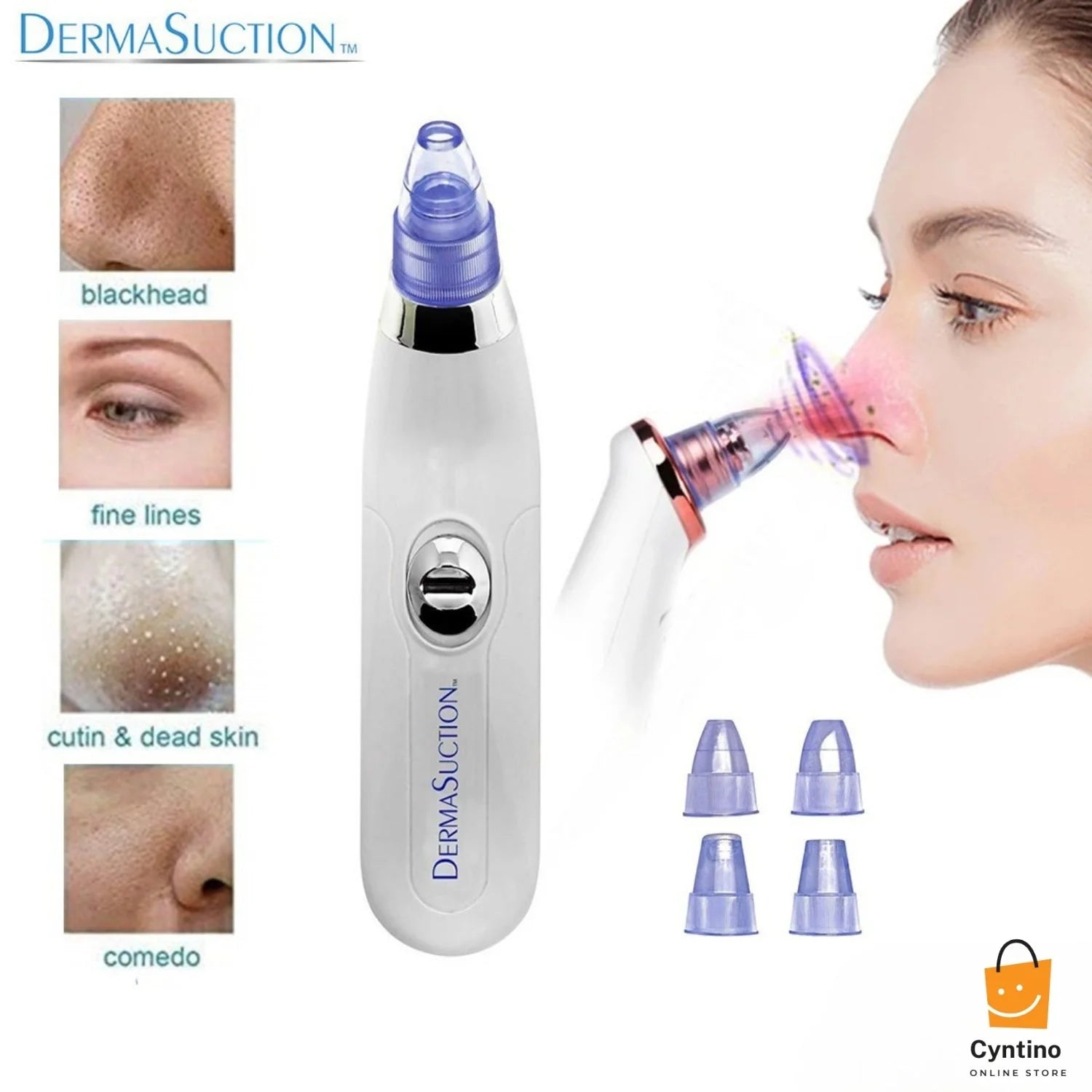 4-in-1 Blackhead Removal Machine Portable Derma Suction Device Battery Operated Cyntinostore