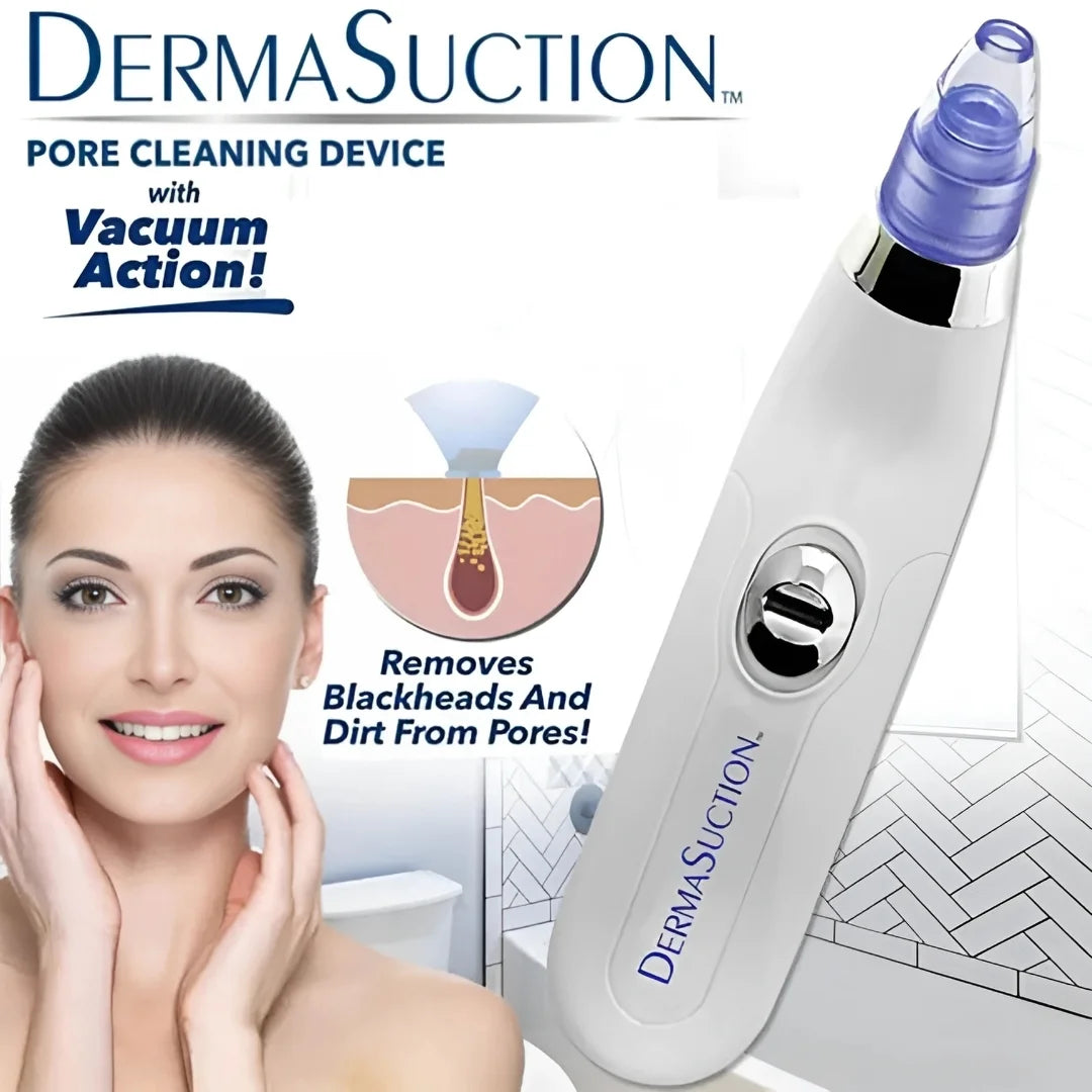 4-in-1 Blackhead Removal Machine Portable Derma Suction Device Battery Operated